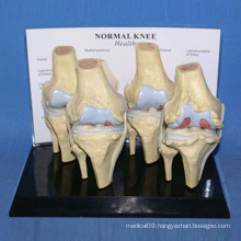 High Quality Human Knee Joint Skeleton Body Parts Model (R020904)